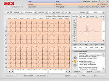 seca Sport ECG Software