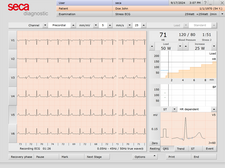 seca Stress ECG Pro Software